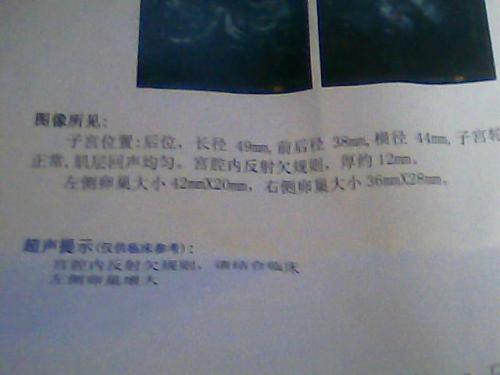 呼和浩特药流没干净清宫多少钱