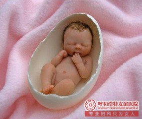 引产手术 呼和浩特人流医院 怀孕4个月能做人流吗?